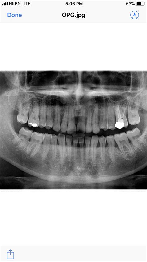 Ask a Dentist Online for Periodontal Disease