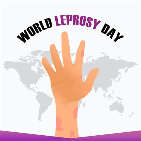 Premium Vector World Leprosy Day Vector Illustration World Leprosy