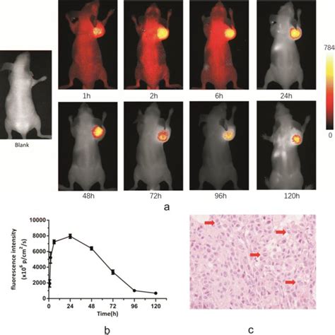 A Ex Vivo Fluorescence Imaging Of The Tumor And Some Main Organs By