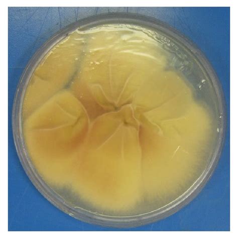 Sabourauds Dextrose Agar Without Cycloheximide Showing Cottony White