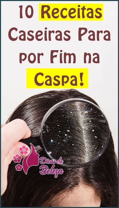 As 10 Receitas Caseiras Para por fim na Caspa Remédios caseiros para