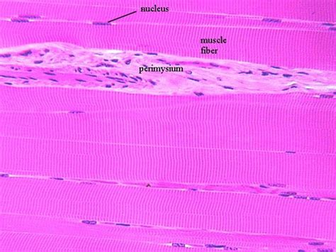 STRIATED, SKELETAL MUSCLE | Microanatomy Web Atlas | Gwen V. Childs, Ph.D.