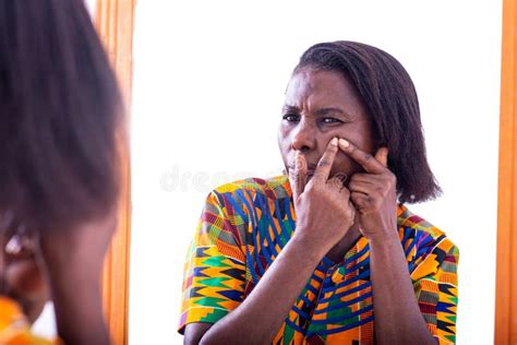 Close Up Of A Mature Woman Squeezing Acne On Her Face Stock Image Image Of Squeeze Facial