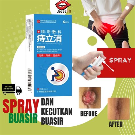 Hemorrhoids Medical Spray Internal External Hemorrhoids Removal Eliminator Anal Fissure Pain