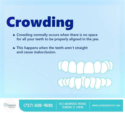 We Can Successfully Correct Crowding Of Teeth With The Orthodontic