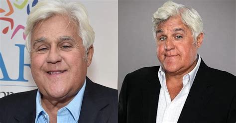 Jay Leno Shows Off His Brand New Face Following Accident