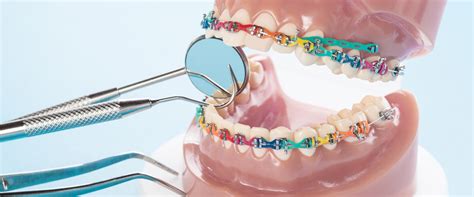 What Does An Orthodontist Do That A Dentist Doesnt