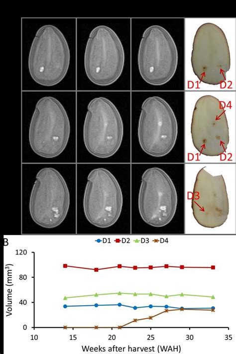 A D Fast Spin Echo Mri Images Echo Time Ms Repetition Time