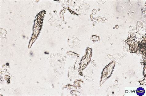 Demodex
