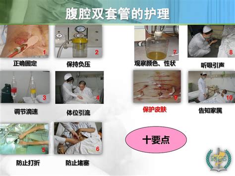 肠瘘合并腹腔感染病人的护理word文档在线阅读与下载无忧文档