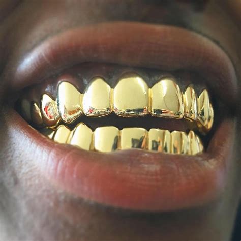 Gold Teeth Grillz K Solid Tops Custom Fit Made To Order Etsy