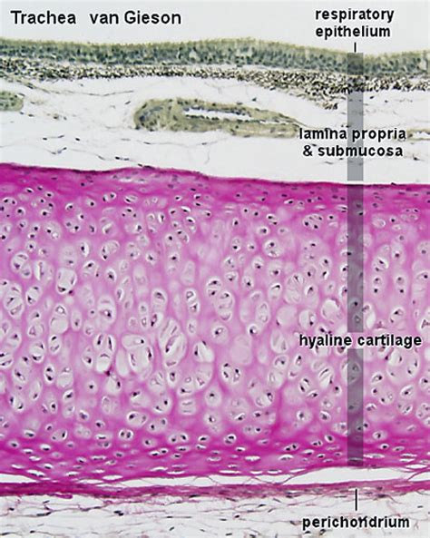 File:Hyaline cartilage 04.jpg - Embryology