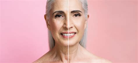 complete guide  facelift surgery