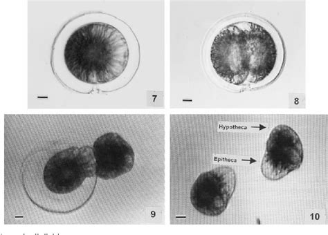 Figure 7210 From Life History Of A Marine Dinoflagellate Pyrophacus Steinii Schiller Wall Et