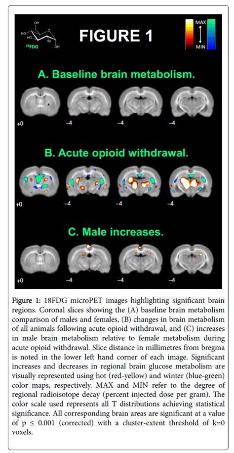 Imaging Sex Differences In Regional Brain Metabolism During Acute