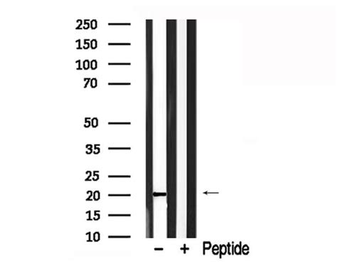 Phospholamban Polyclonal Antibody Pa5 115753