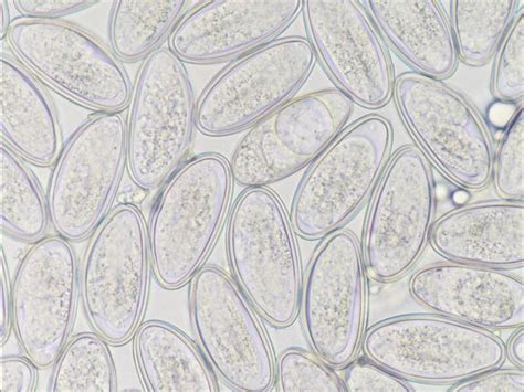 Enterobius Vermicularis Egg