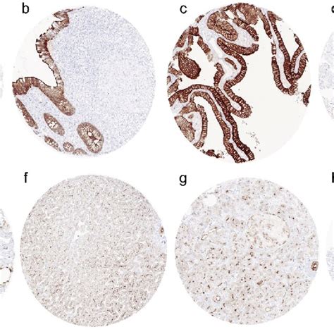 Villin Immunostaining In Normal Tissues The Panels Show A Strong