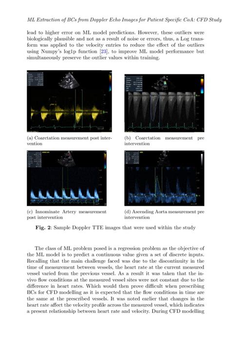 Machine Learning Based Extraction Of Boundary Conditions From Doppler