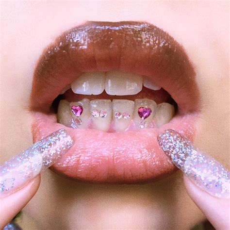 Bijoux Dentaires Paris On Instagram Icycestparis Toothgems