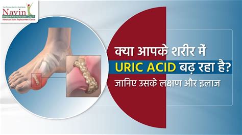 क्या आपके शरीर में Uric Acid बढ़ रहा है जानिए उसके लक्षण और इलाज In Hindi Dr Karan Mehta