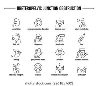 Ureteropelvic Junction Obstruction Symptoms Diagnostic Treatment Stock ...