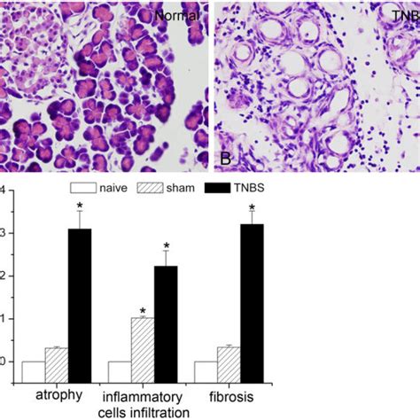 Trinitrobenzene Sulfonic Acid Tnbs Infusion Induced Rat Chronic