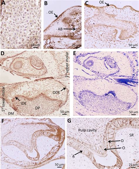 Tooth Morphogenesis and FGF4 Expression During Development of Molar Tooth in Three Muroid ...