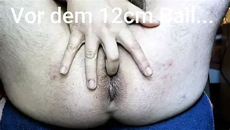 Gummi Fisting Gay Gaping HD Porn Video B XHamster