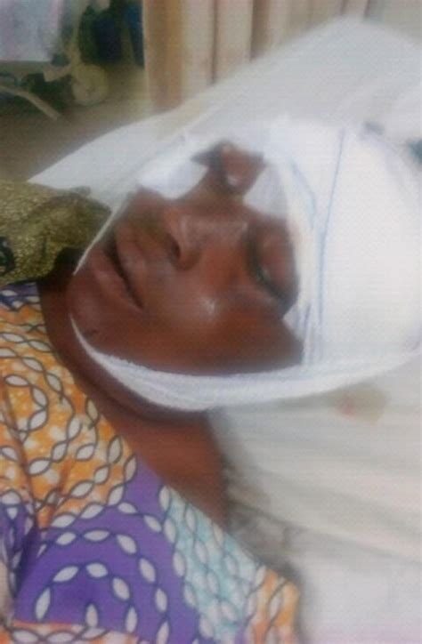 Woman Sustains Deep Wounds From Husband After Denying Him Sex MyJoyOnline