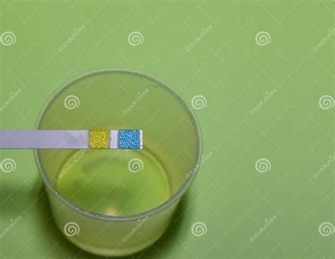 Urine Examination For Screening Hypertension And Diabetes In Pregnancy