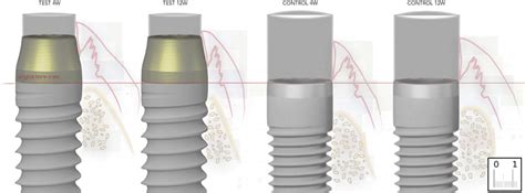 F I G U R E 1 2 Scaled graphical representation of the buccal hard and... | Download Scientific ...