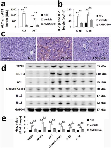 AMSC Derived Exosomes Alleviate Lipopolysaccharide D Galactosamine