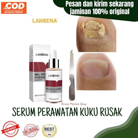 Jual Lanbena Nail Repair Essence Oil Serum Nail Treatment Untuk Atasi