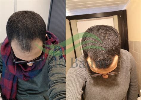 Pelo Baum - инновационная пептидная линия для роста волос | DoctorHair.ru