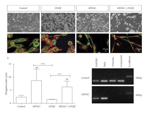 Hdac Activity Blockade Leads To Tumor Cell Shape Changes In Parallel To