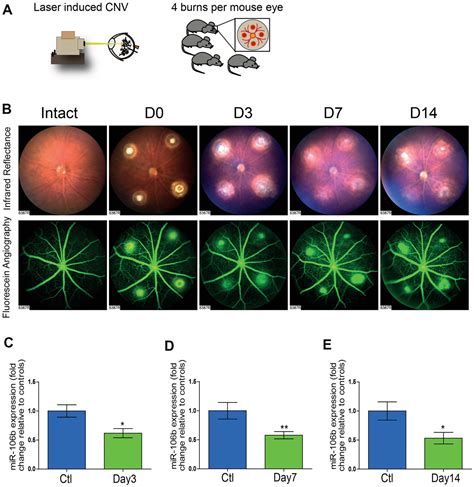 MiR 106b Suppresses Pathological Retinal Angiogenesis Figure F1 Aging