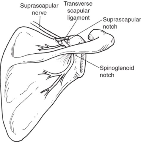 Suprascapular Nerve Decompression Musculoskeletal Key