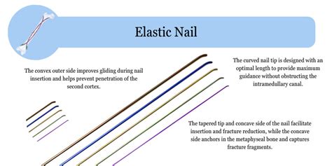 titanium elastic nail  orthopedic implants   surgery