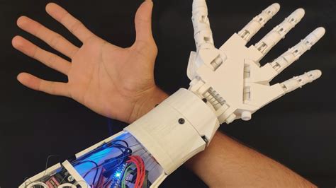 Designing A 3D-printed EMG Bionic Hand As A Low-cost, 50% OFF