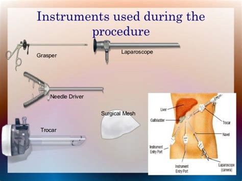 Instruments and Devices Used in Laparoscopic Surgery » Medicomart.in ...