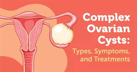 Types Of Cysts In Women