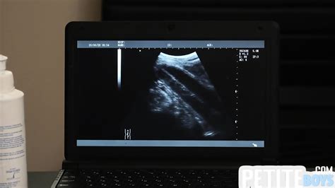 Bottom Petite Gay Fucked In Anal Hole By Dirty Doctor