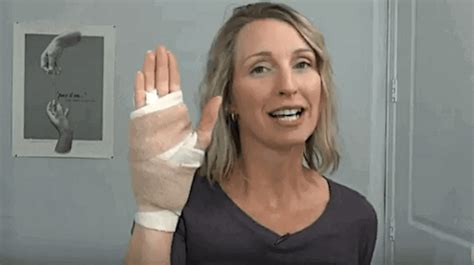 Guide To Recovery For Carpal Tunnel Surgery