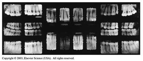 Dental Radiology Fmx