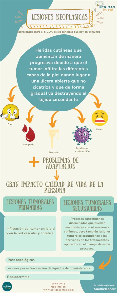 Infografía Lesiones Neoplásicas Heridas En Red