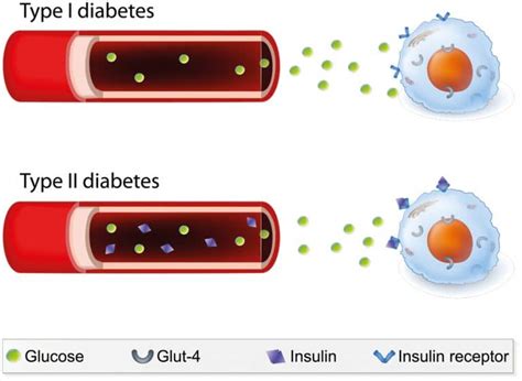 diabetes treatment  carbonates   alternative research outreach