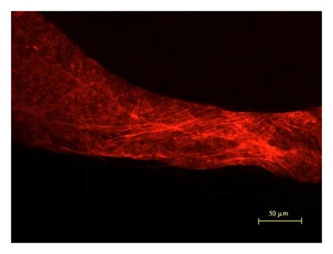 Dapi And Phalloidin Images Of A Lymph Vessel The Patterns Of
