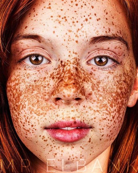 Pecas Culturainquieta2 People With Freckles People With Red Hair Red