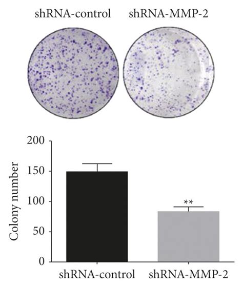 Knocking Down Mmp 2 Expression Inhibits Nasopharyngeal Cancer Cell